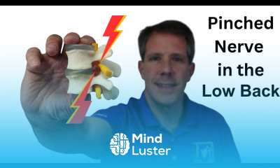 5 Signs of a Pinched Nerve in the Lower Back