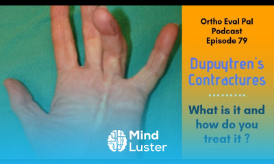 Learn Ortho Eval Pal Episode 79 Dupuytren s Contractures - Mind Luster