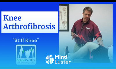 How to Treat an Arthrofibrotic Knee in Physical Therapy