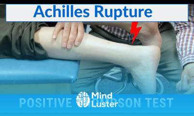 How to Perform a Thompson Test on a Patient with a COMPLETE ACHILLES RUPTURE