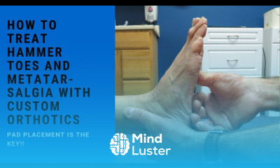 How to Treat Hammer Toes and Metatarsalgia with Custom Orthotics