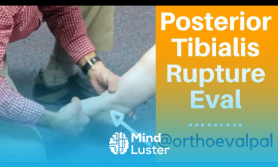 Posterior Tibialis Rupture Evaluation