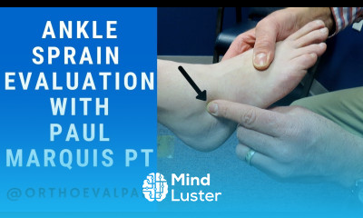 Ankle Sprain Evaluation with Paul Marquis PT
