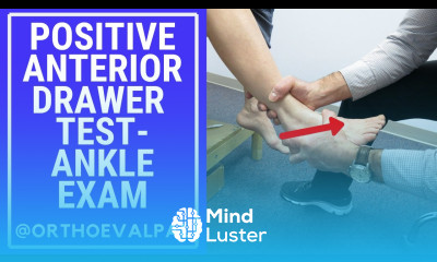 Learn Positive Anterior Drawer Test Ankle Exam - Mind Luster