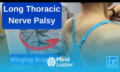 Long Thoracic Nerve Palsy Winging Scapula