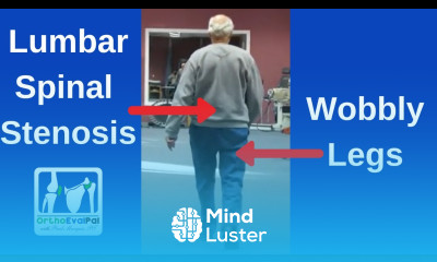 Lumbar Spinal Stenosis Symptoms Neurogenic Claudicatiion