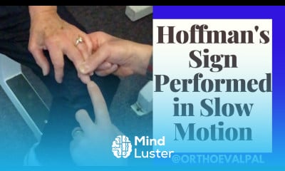 Hoffman s Sign Performed in Slow Motion