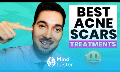 How To Get Rid Of Acne Scars Treatment and Removal