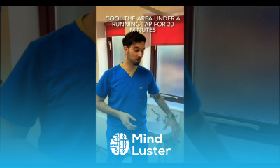 2 Top Tips To Treat A Burn