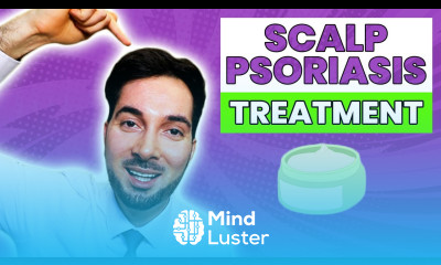 Scalp Psoriasis Removal and Best Treatment At Home