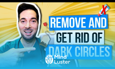 Dark circles under eyes home remedy and how to get rid remove