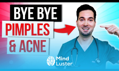 How to get rid of acne treatment and pimples overnight