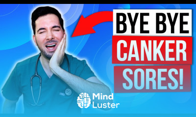 How to get rid of canker sores inside your mouth fast and treatment