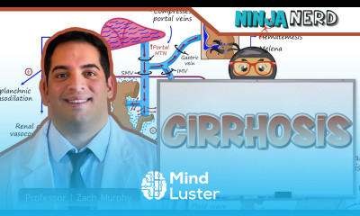 Cirrhosis Clinical Medicine