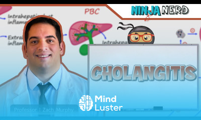 Cholangitis Clinical Medicine