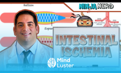 Intestinal Ischemia Clinical Medicine