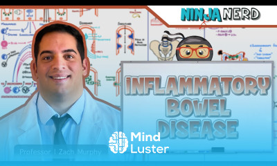 Inflammatory Bowel Disease IBD Clinical Medicine