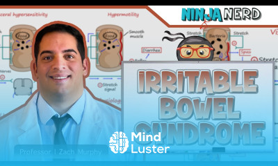 Irritable Bowel Syndrome IBS Clinical Medicine