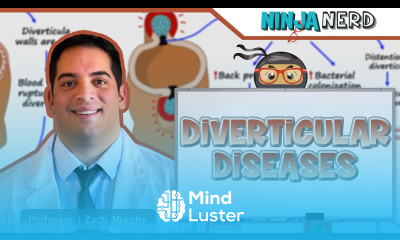 Diverticular Diseases Clinical Medicine