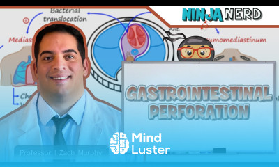 Gastrointestinal Perforation Clinical Medicine