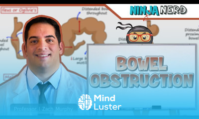 Bowel Obstruction Clinical Medicine