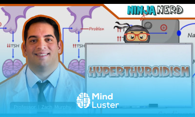 Hyperthyroidism Clinical Medicine