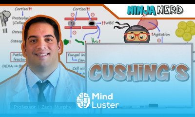 Cushing s Syndrome and Disease Clinical Medicine