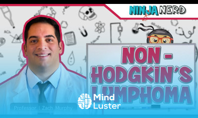 Non Hodgkin s Lymphoma