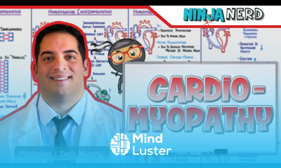 Cardiomyopathy Clinical Medicine