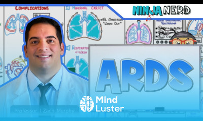 Acute Respiratory Distress Syndrome ARDS Clinical Medicine