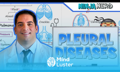 Pleural Diseases Pleural Effusion Pneumothorax Clinical Medicine