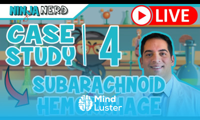 Case Study 4 Subarachnoid Hemorrhage