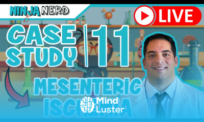 Case Study 11 Acute Mesenteric Ischemia