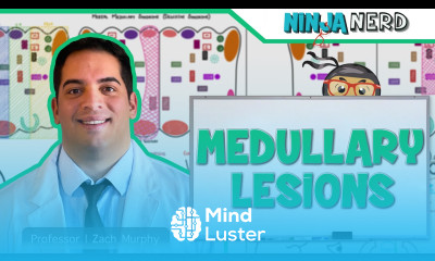 Medullary Lesions Medial and Lateral Medullary Syndromes