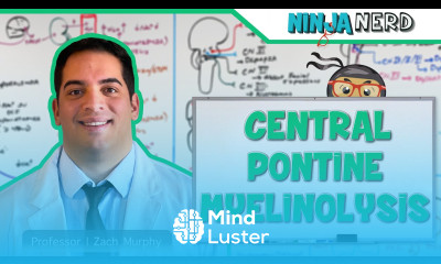 Central Pontine Myelinolysis Osmotic Demyelination Syndrome