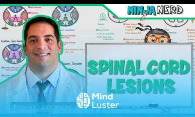 Spinal Cord Lesions Anterior Cord Posterior Cord Central Cord Brown Sequard