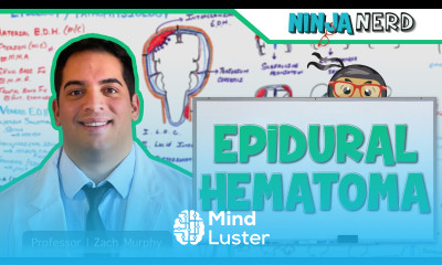 Epidural Hematoma Anatomy Etiology Pathophysiology Clinical Features Treatment