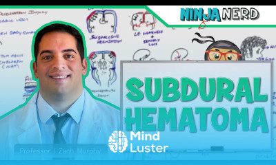 Subdural Hematoma Anatomy Etiology Pathophysiology Clinical Features Treatment
