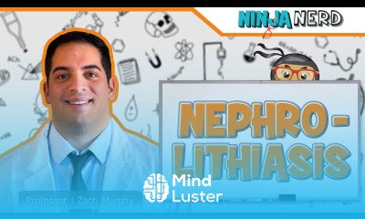 Nephrolithiasis Kidney Stones