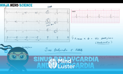 Rate and Rhythm Sinus Bradycardia and Sinus Tachycardia