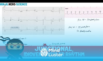 Rate and Rhythm Junctional and Idioventricular Rhythm