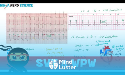 Rate and Rhythm Supraventricular Tachycardia SVT and Wolff Parkinson White WPW Syndrome