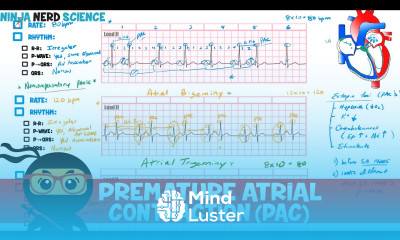 Rate and Rhythm Premature Atrial Contraction PAC