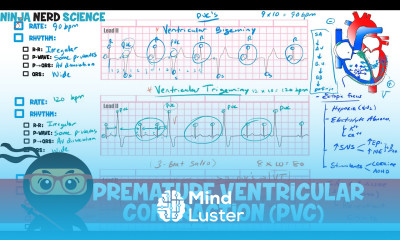 Rate and Rhythm Premature Ventricular Contraction PVC