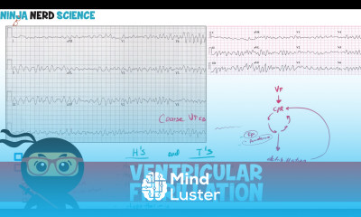 Rate and Rhythm Ventricular Fibrillation
