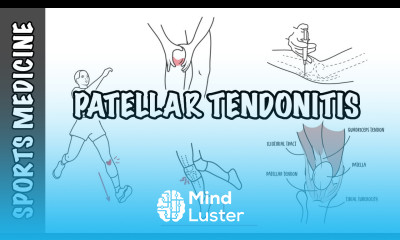 Patellar Tendonitis and Patellar Tendinopathy