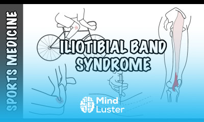 Iliotibial Band Syndrome ITBS Overview