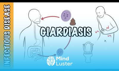 Giardiasis Giardia Lamblia Giardia intestinalis Giardia duodenalis infection