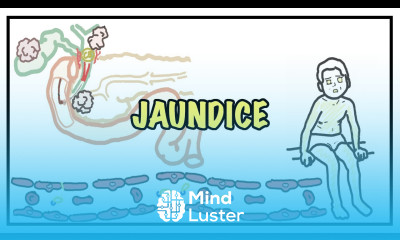 Approach to Jaundice types and causes of hyperbilirubinemia investigations