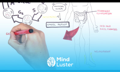 Acute Complications of Chemotherapy side effects adverse effects